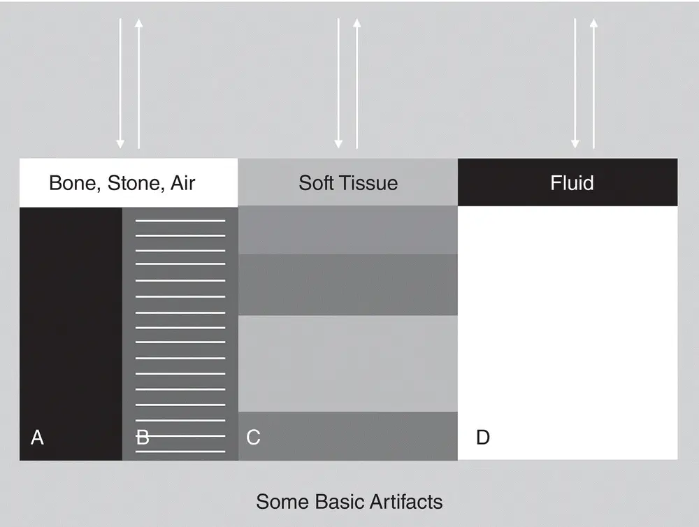 Figure 15 Ultrasound and different tissues and elements Schematic that ties - фото 9