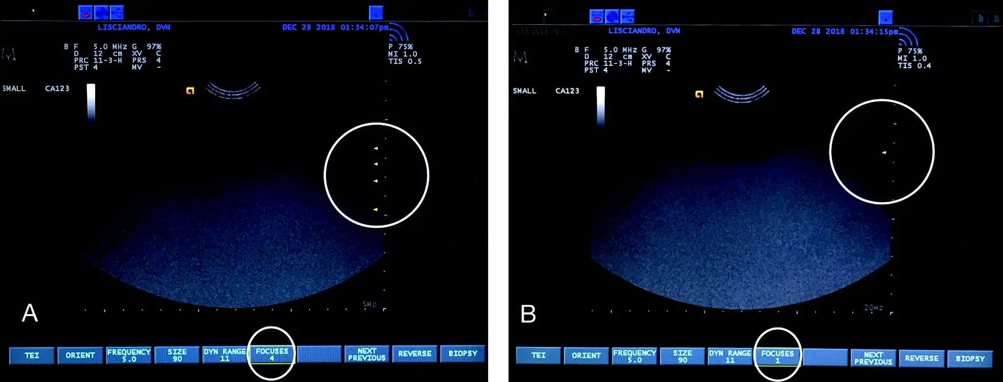 Figure 512 Focus cursor and depth In A there are four focus cursors - фото 44
