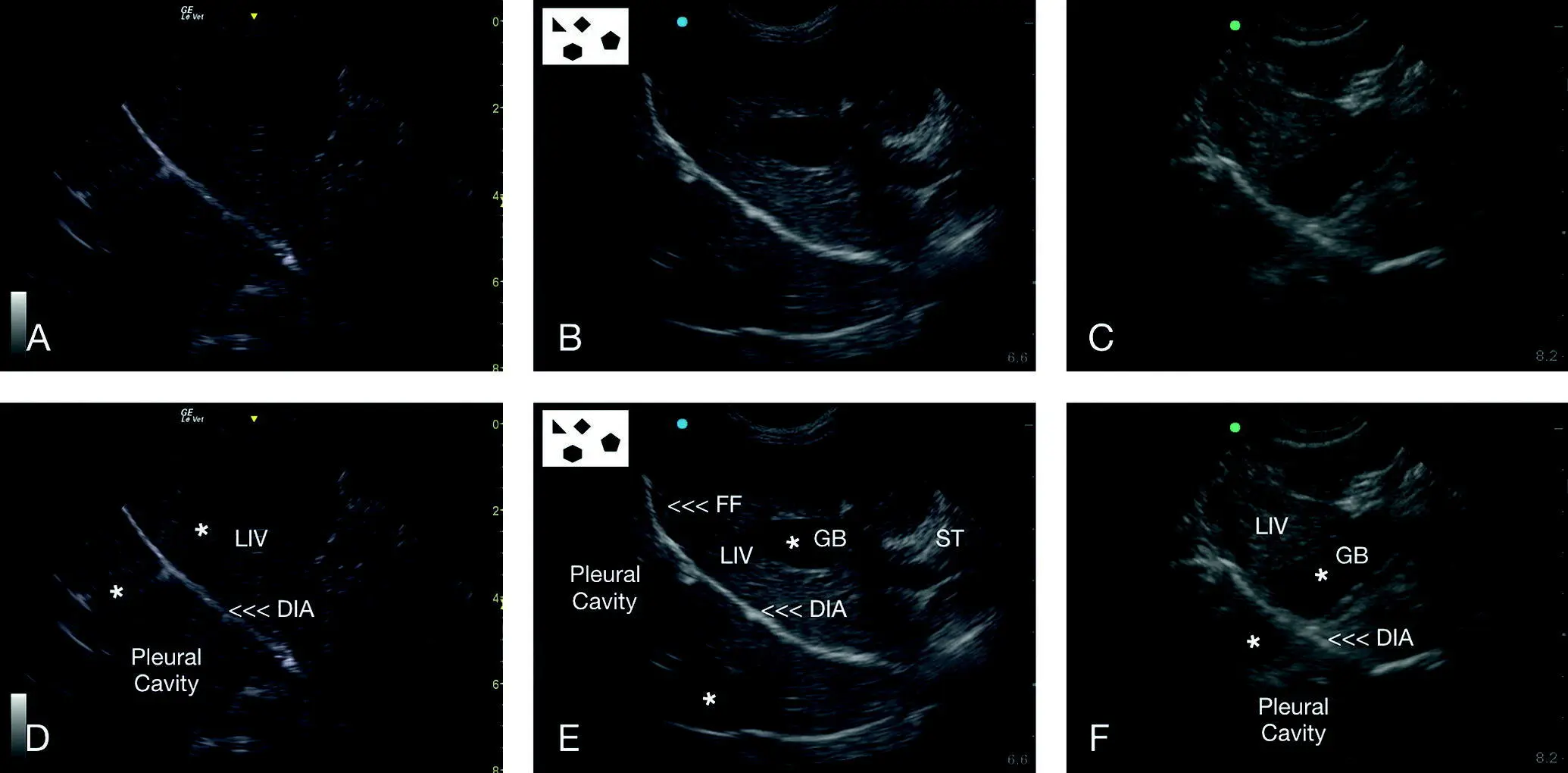 Figure 613 Mirror image artifact at the DH view Mirror image artifact occurs - фото 60