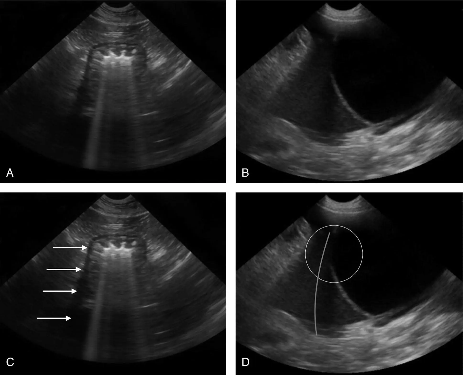 Figure 32 Edge shadowing artifact A An edge shadowing artifact is seen - фото 16