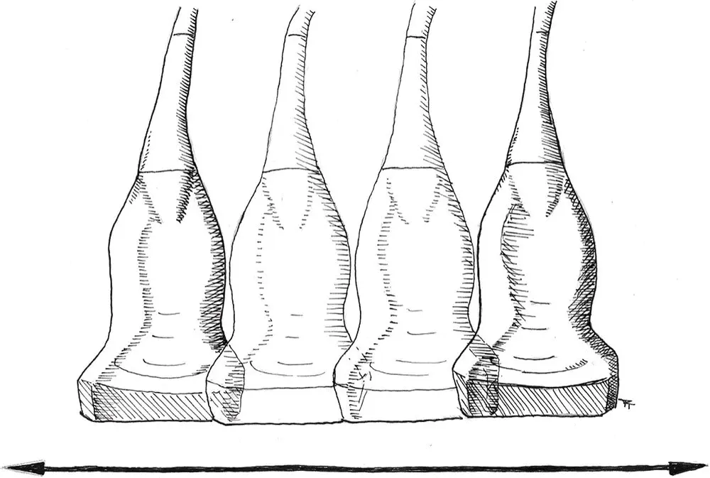 Figure 49 Sliding The probe is moved across the body in the longitudinal - фото 30