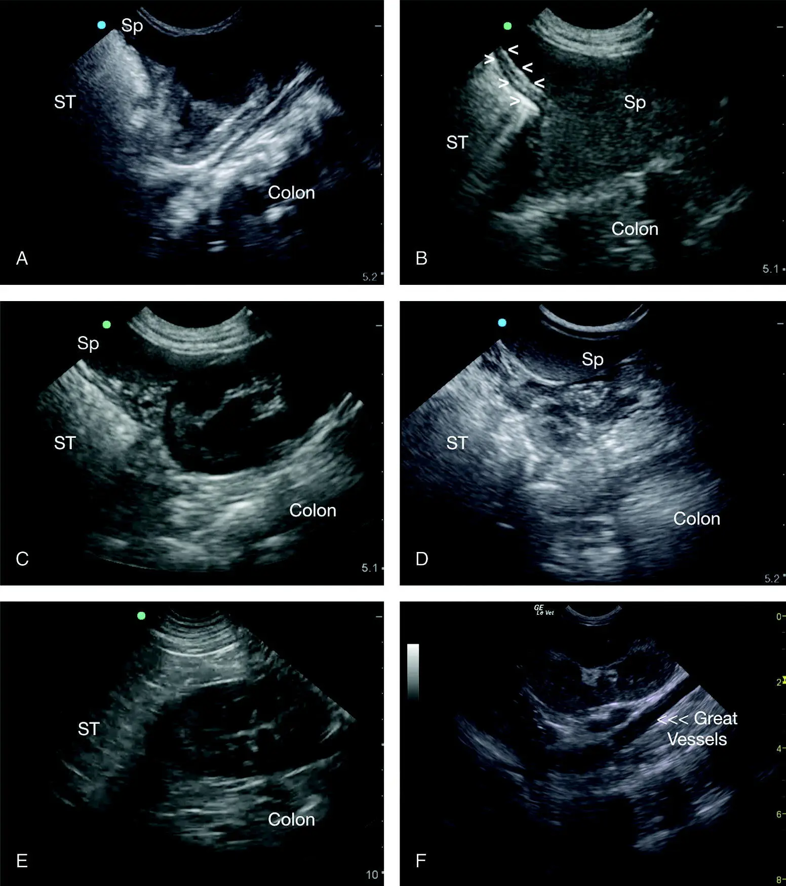 Figure 618 Examples of typical negative studies at the SR view In A the - фото 65