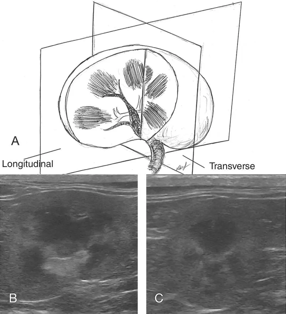 Figure 42 Examples of image planes for the kidney In A the kidney is shown - фото 23