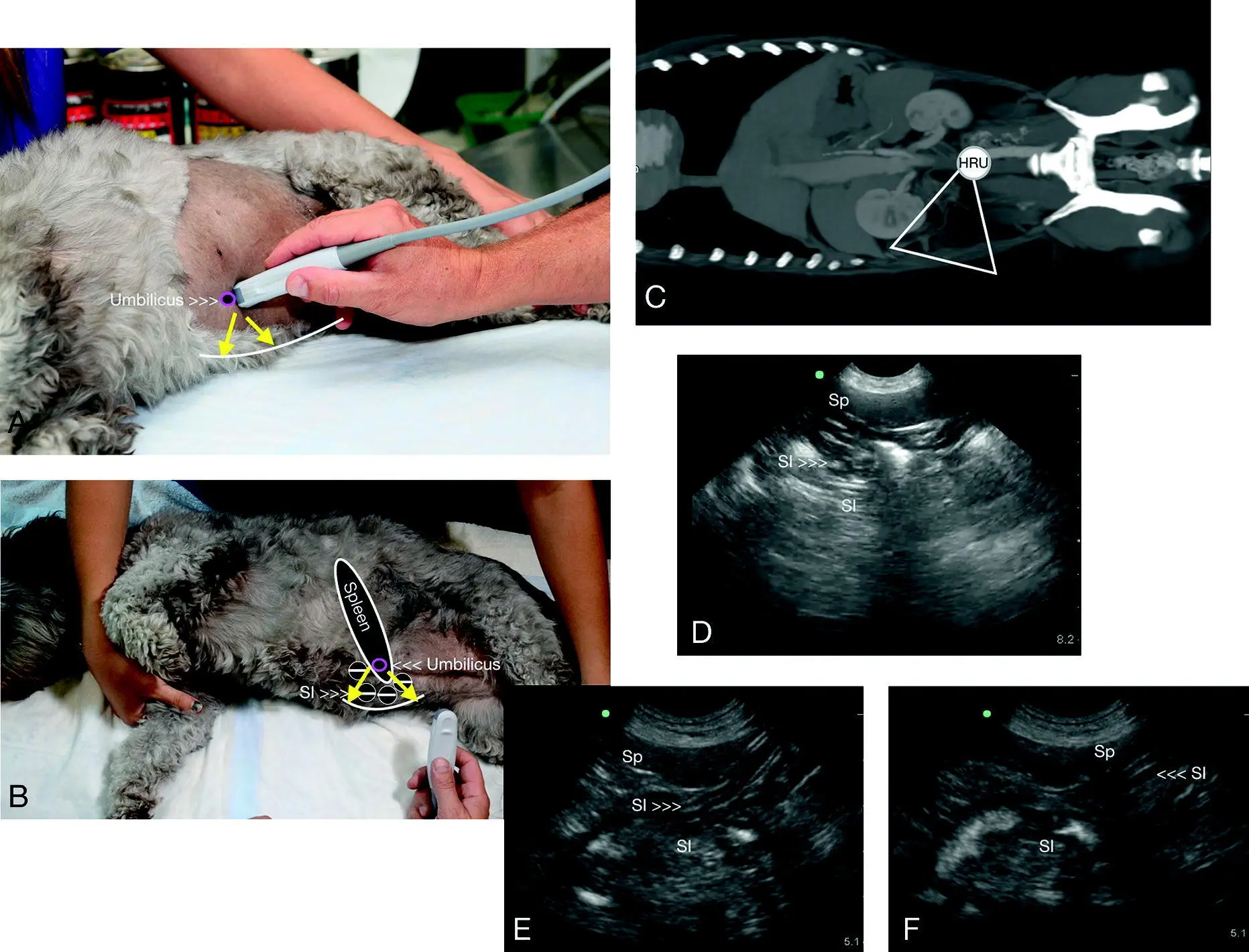 Figure 630 HRU view in a dog In A and B the direction of the probe is - фото 77