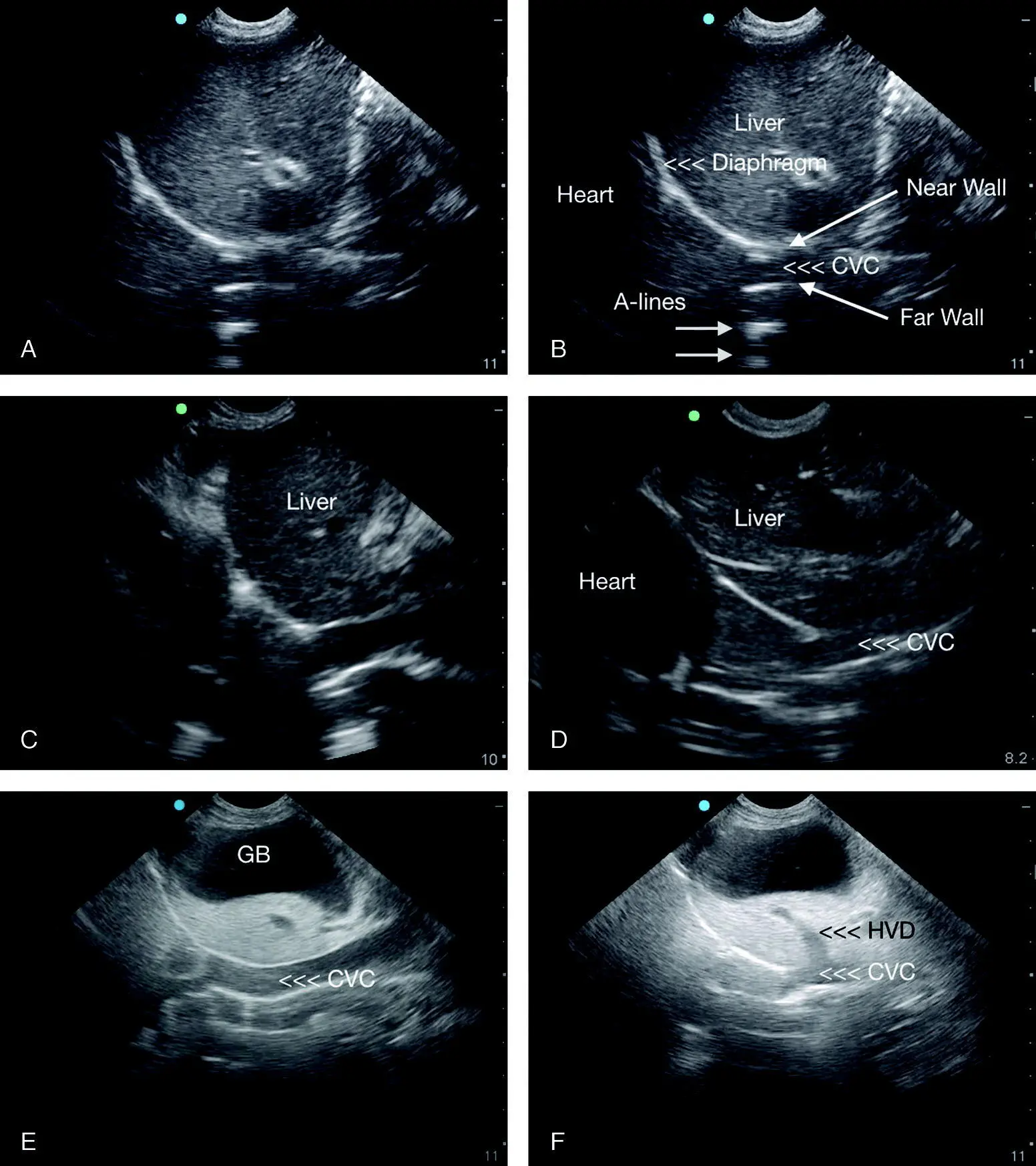 Figure 612 Variety of typical CVC images with other relevant structures A - фото 59