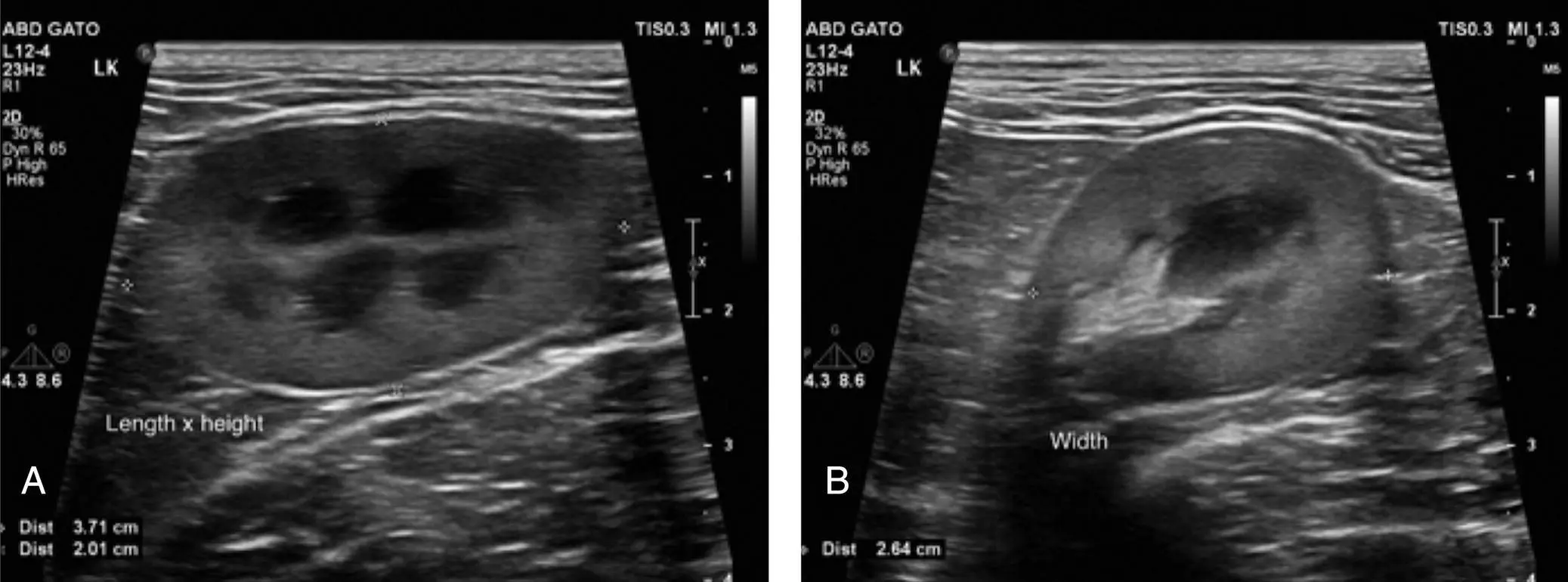 Figure 55 Anatomy generally better recognized in longitudinal sagittal - фото 37