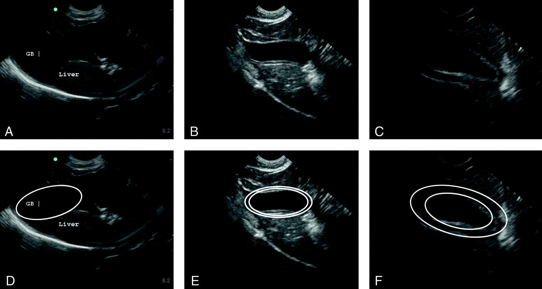 Figure 711 Gallbladder wall edema in dogs with anaphylaxis Three different - фото 89