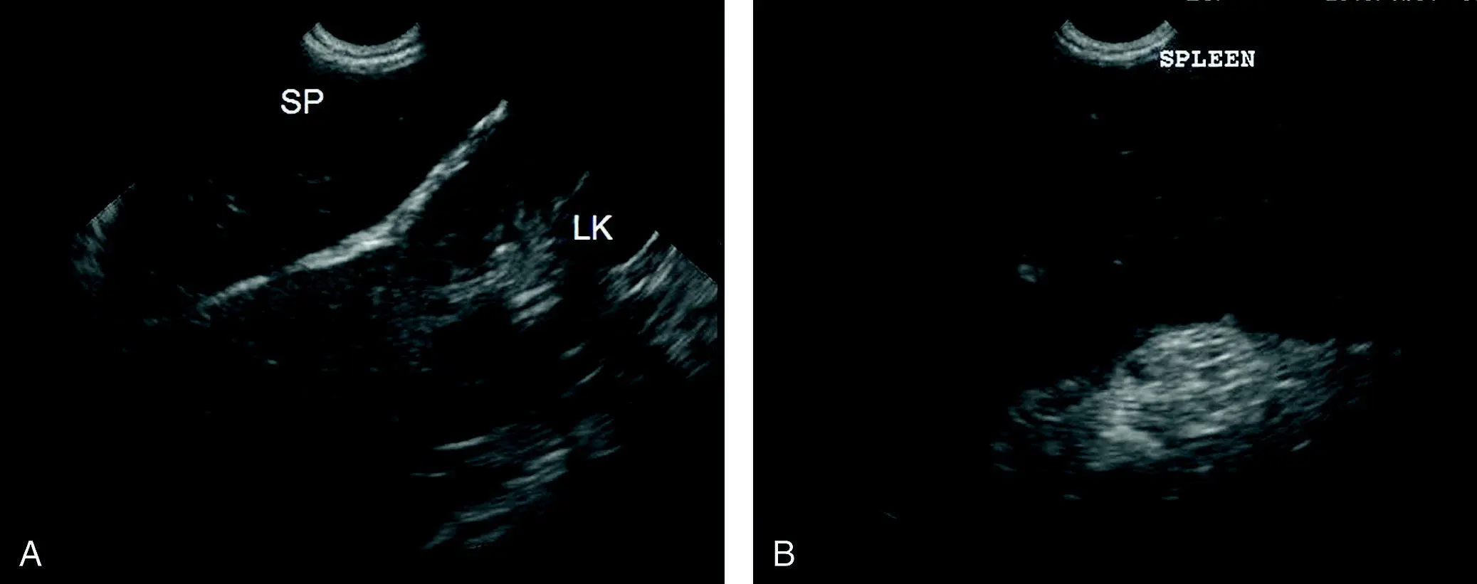 Figure 915 Splenic torsion parenchymal lesion A Note the hypoechoic dark - фото 112
