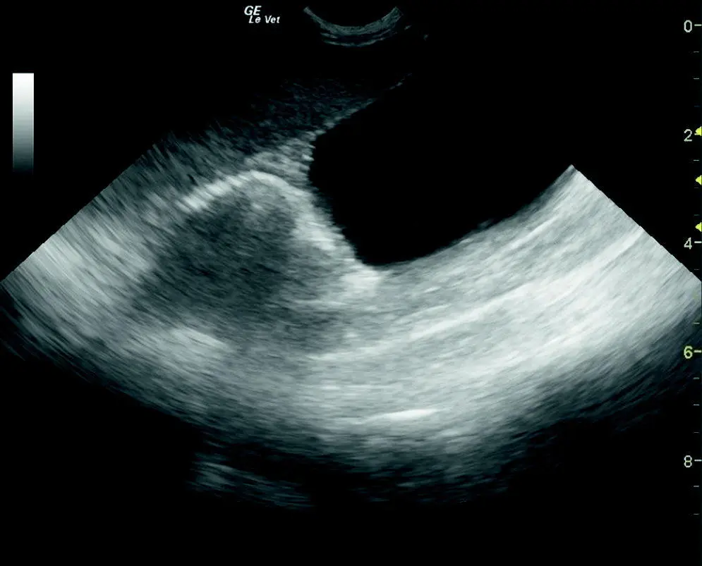 Figure 96 Splenomegaly with spleen extending to urinary bladder This - фото 106