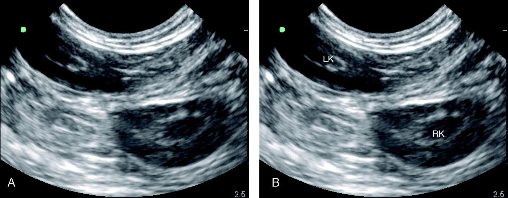 Figure 621 Both kidneys in view at the SR view In the cat and the small dog - фото 68