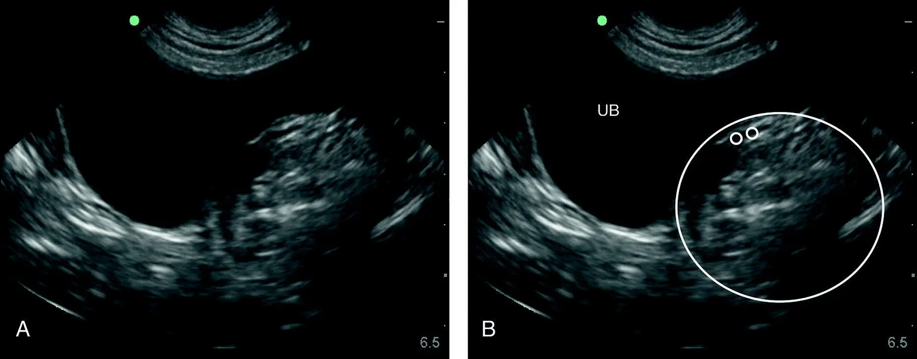 Figure 629 Pitfall of the thigh or a mass or other In A and B are - фото 76