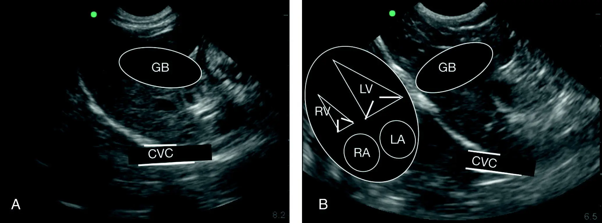 Figure 714 Relative positioning of gallbladder to diaphragm to caudal vena - фото 92