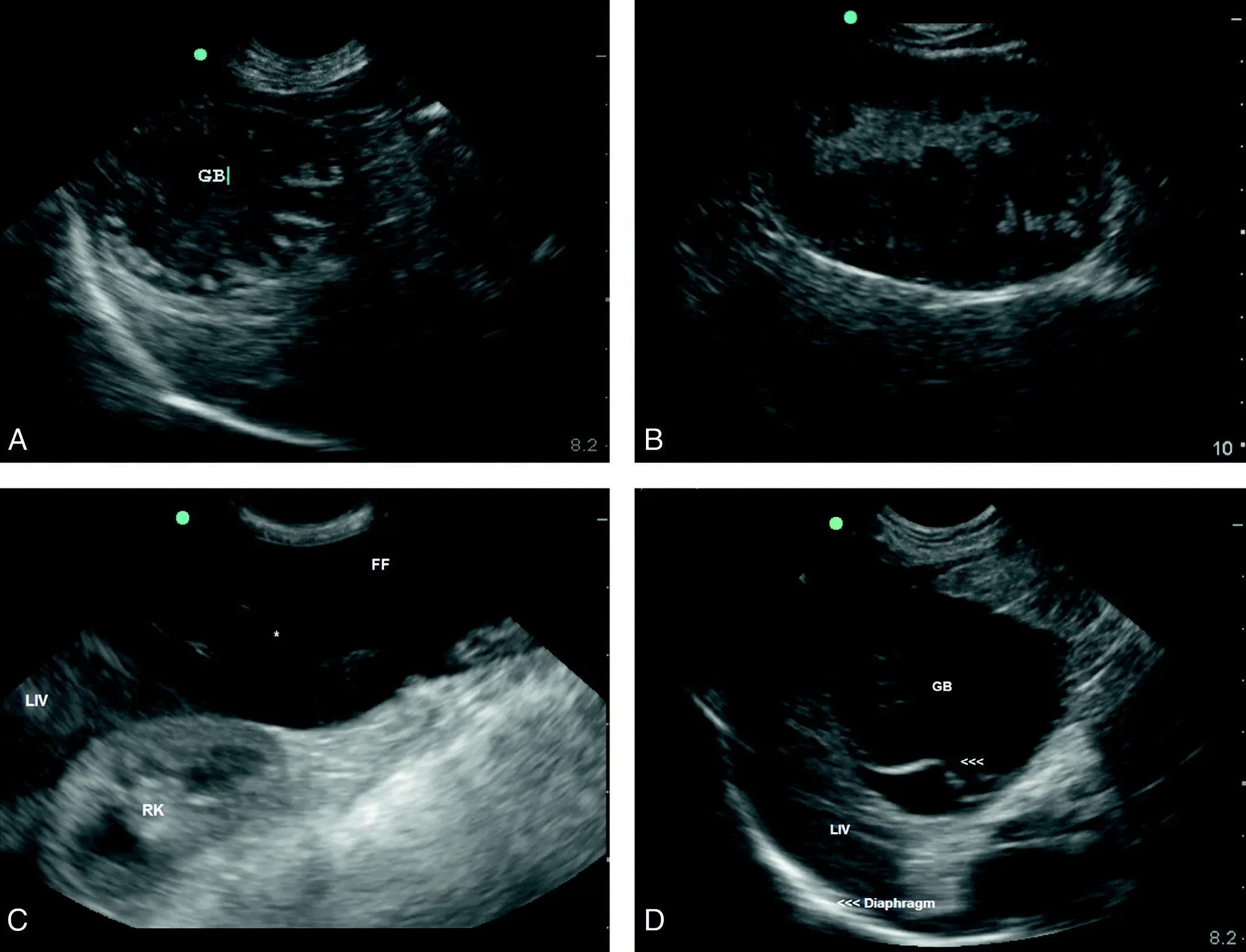 Figure 814 Gallbladder mucocele A Gallbladder mucocele in a dog Note the - фото 99