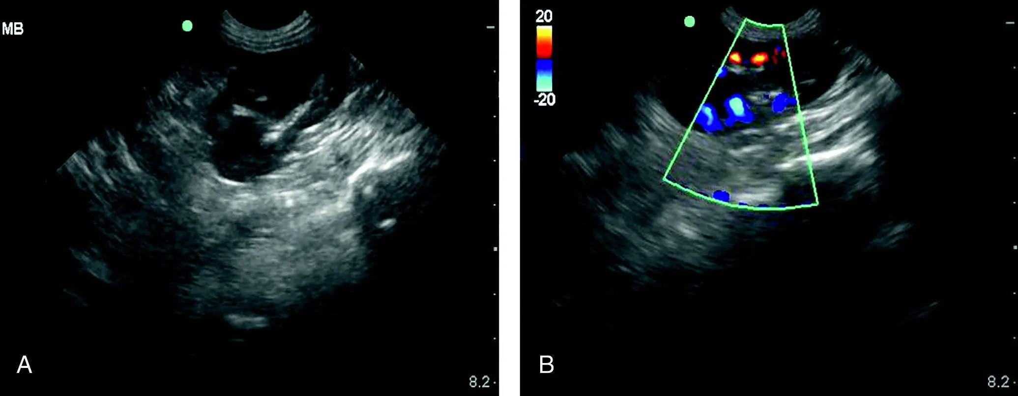 Figure 77 Evaluating for blood flow of the left kidney at the SR view In - фото 85