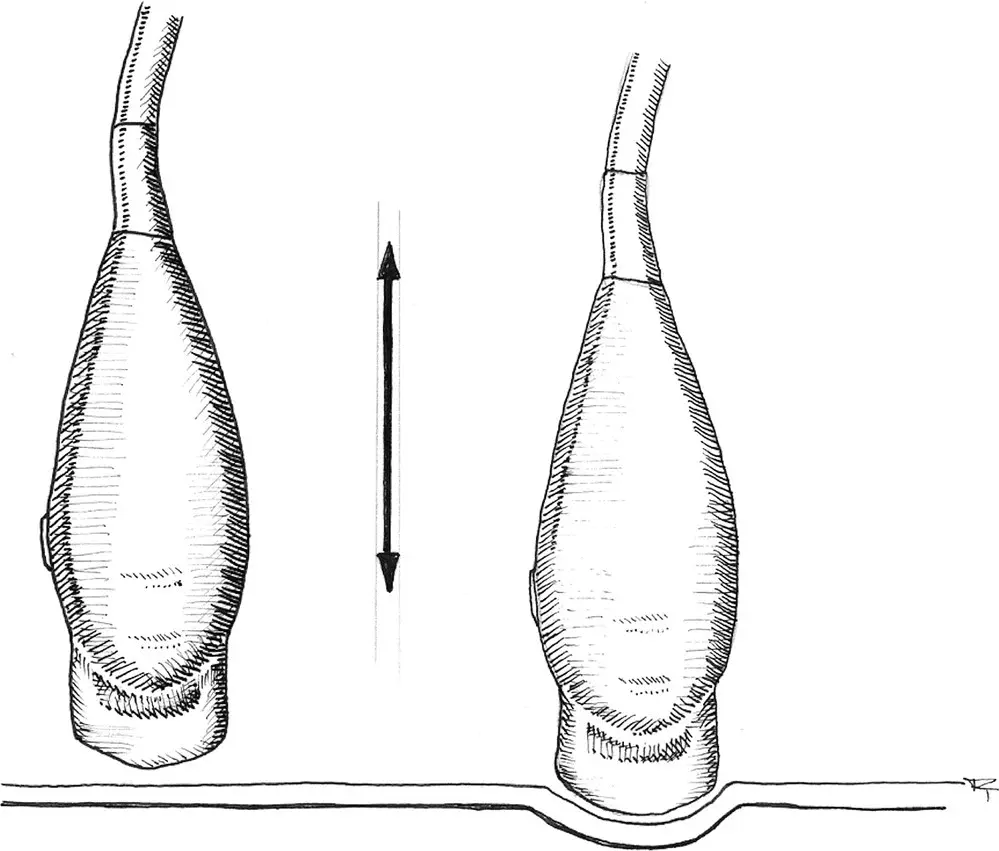 Figure 411 PressureCompression Neither the probe position on the body nor - фото 32