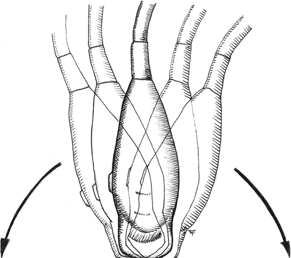 Figure 46 Rocking The position of the probe is not moved on the patient and - фото 27