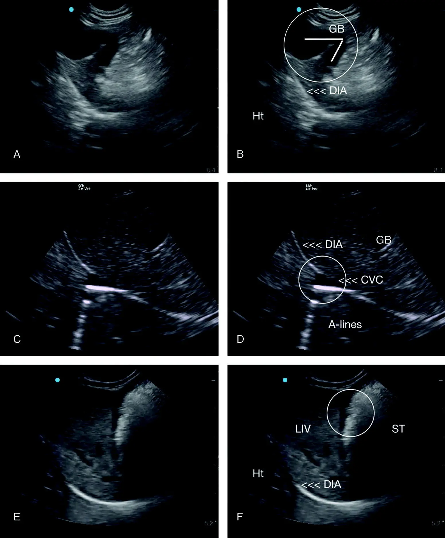 Figure 616 Additional examples of pitfalls at the DH view A and B are - фото 63