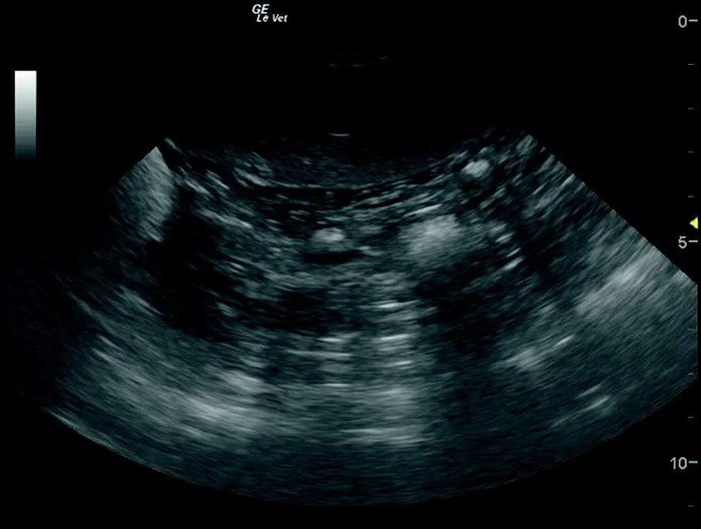 Figure 94 Normal appearance of spleen Spleen by itself showing its - фото 104