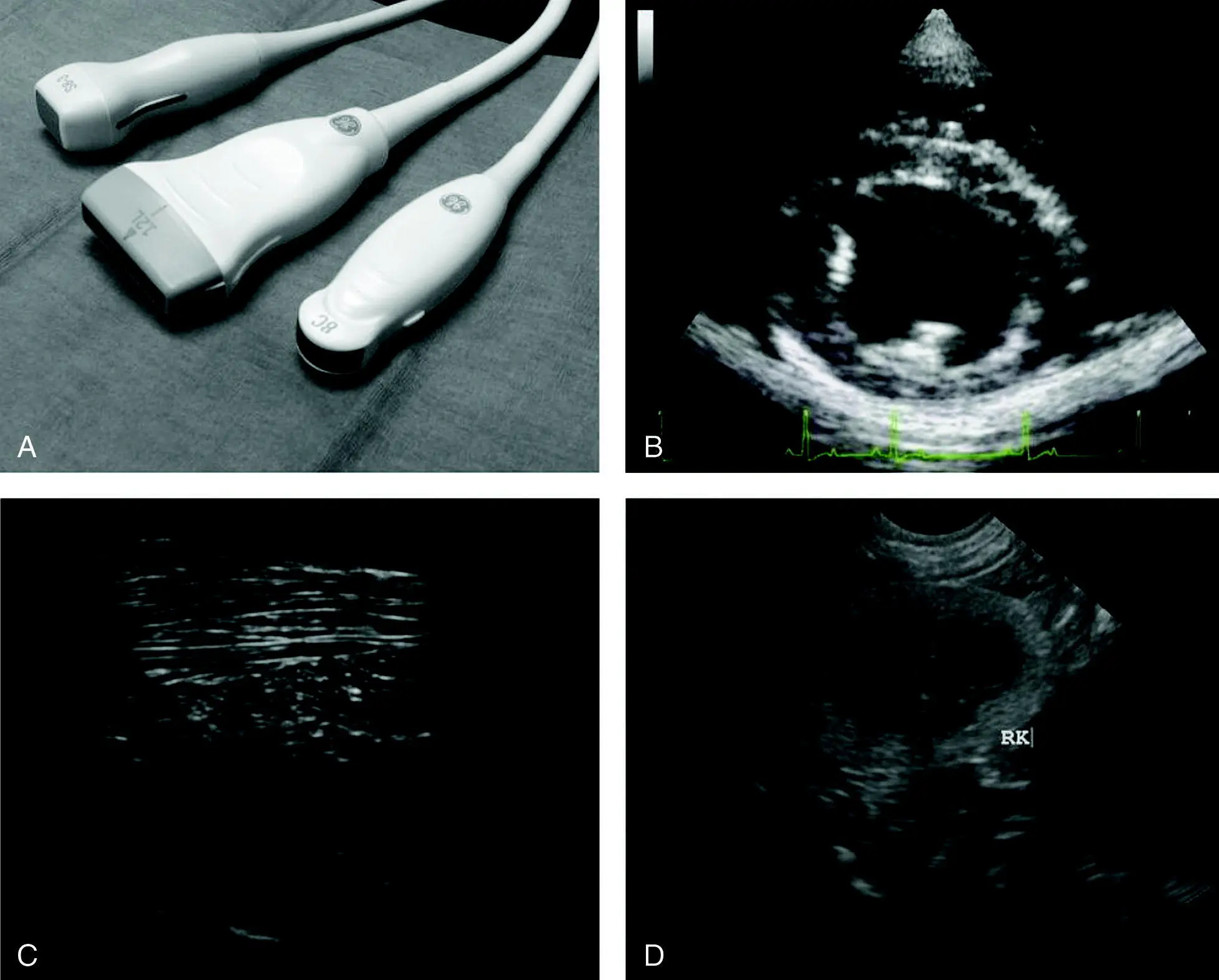 Figure 44 Electronic ultrasound probes and their characteristic Bmode - фото 25