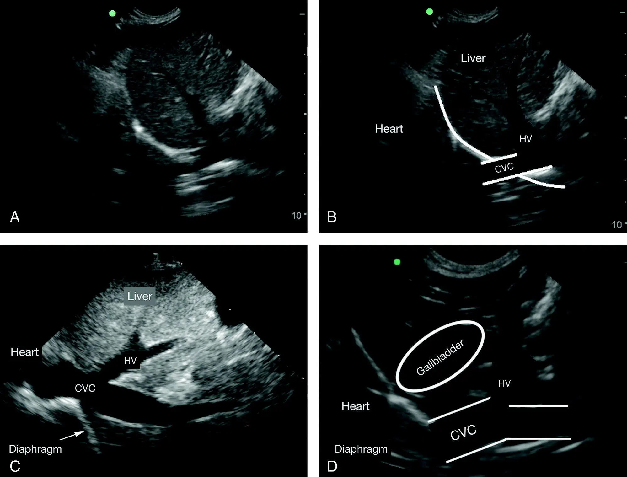 Figure 83 Hepatic venous congestion The differentiation between hepatic - фото 96