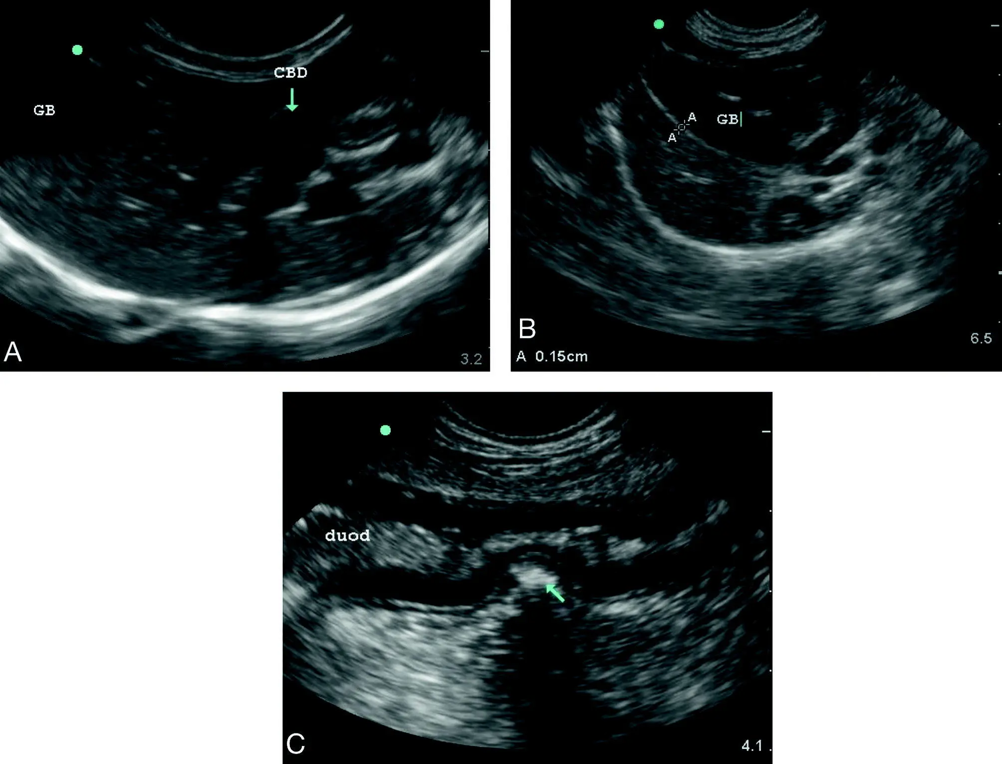 Figure 815Biliary tract distension A Cat with bile duct tortuosity which - фото 100