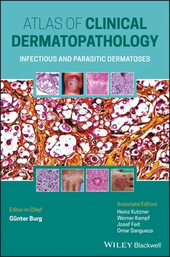 Gunter Burg Atlas of Clinical Dermatopathology обложка книги