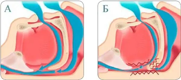 Рисунок 1 Дыхание человека во сне а нормальное дыхание б храп У - фото 1