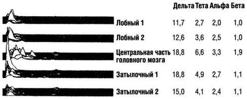Приведенные выше данные показывают базовую активность волновых колебаний - фото 66