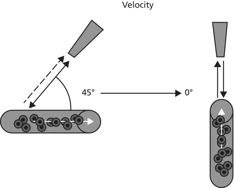 Figure 71 Schematic representing zero angle of insonation between the Doppler - фото 5