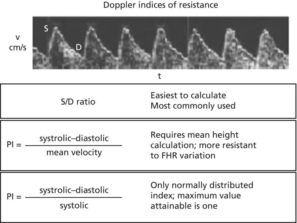 Figure 72 Flow velocity waveform of the umbilical artery and definitions for - фото 6