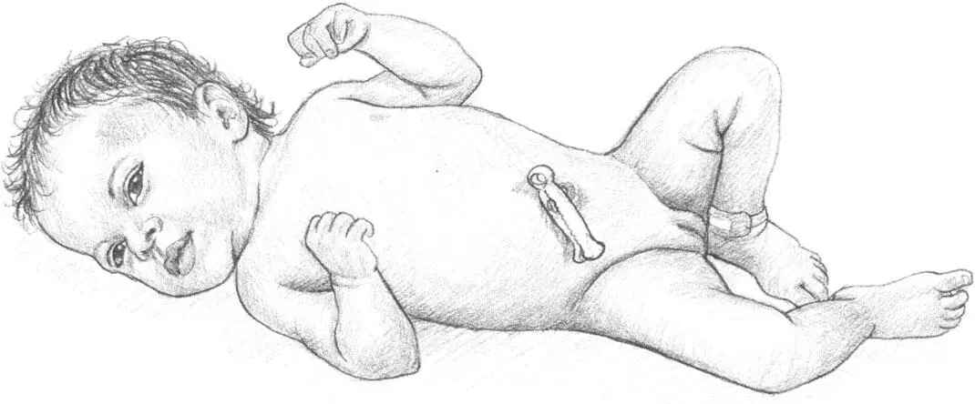 Umbilical clip THIS INSTINCT to nurture and protect almost to make a nest - фото 15