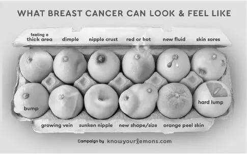 Worldwide Breast Cancer What Breast Cancer Can Look Feel Like Worldwide - фото 4
