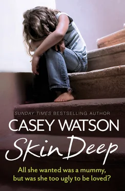 Casey Watson Skin Deep обложка книги