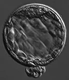 The human embryo at around five days called a blastocyst That ball of cells - фото 13