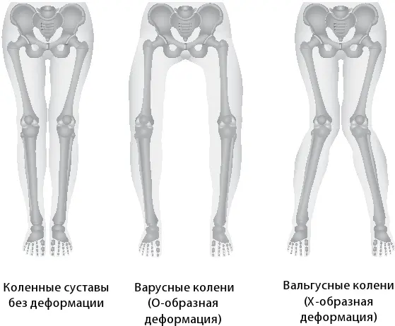 С точки зрения физиологии такая походка естественная Мужчины по секрету тоже - фото 3