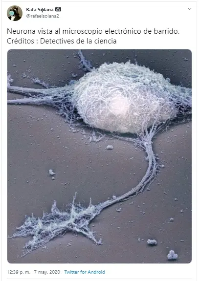 Abbildung 1 Tweet Neuronen unter dem elektronischen Mikroskop Mit - фото 1