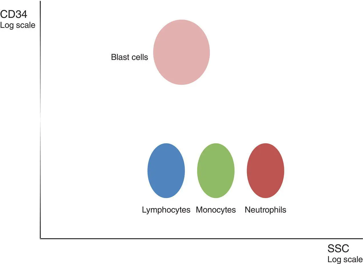 Figure 15 Delineation of peripheral blood or bone marrow CD34 blast - фото 6