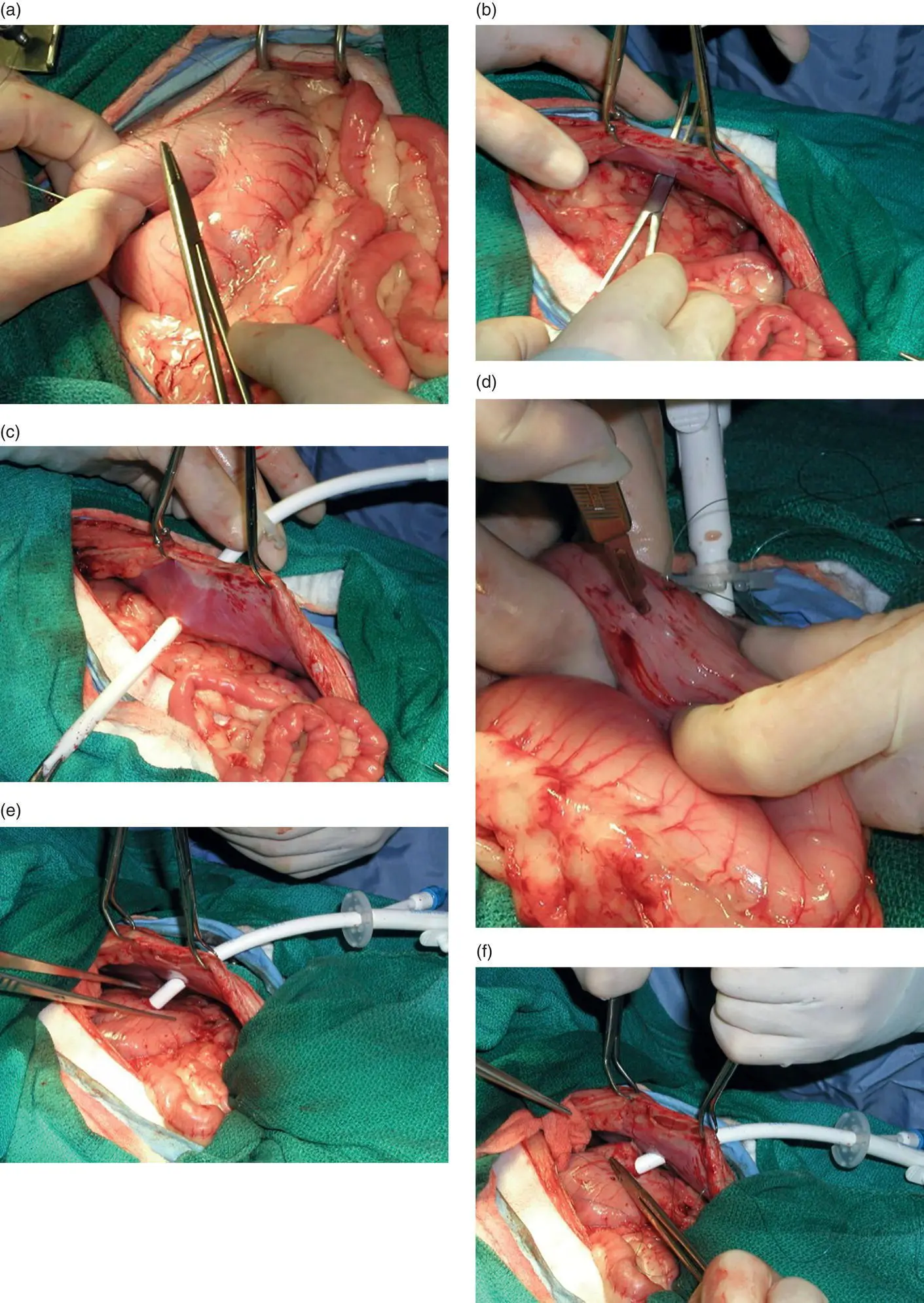 Figure 47 442 Materials and Equipment A small long bore feeding is used - фото 23