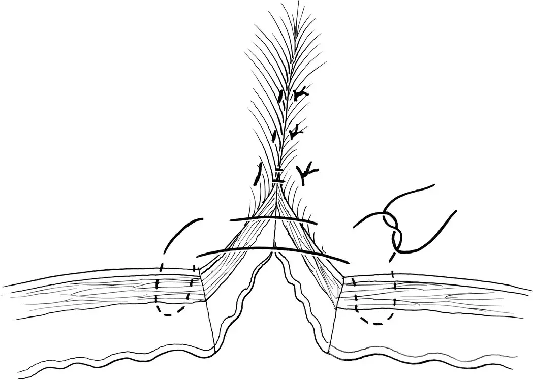 Figure 32 352 Cushing and Connell These continuous patterns are often - фото 11
