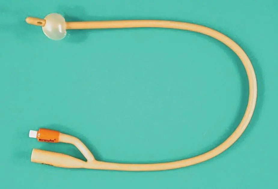 Figure 46 Gastrostomy feeding tubes can be placed surgically during a - фото 22