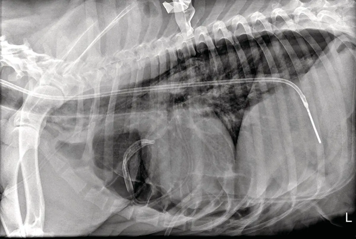 Figure 42 If the patient is coughing the tube should be withdrawn because it - фото 18