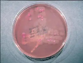 Figure 10 Certain organisms will not grow on media commonly used to culture - фото 12