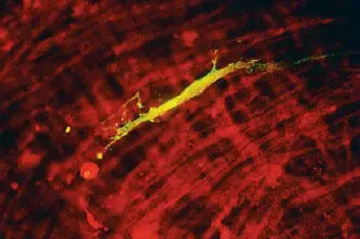 Figure 7 DFA staining is frequently used for the detection of microbes that - фото 9
