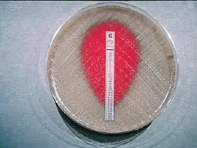 Figure 14 Tissue culture for Chlamydia and viruses Both Chlamydia a - фото 16