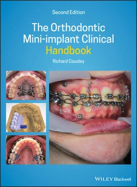 Richard Cousley The Orthodontic Mini-implant Clinical Handbook обложка книги