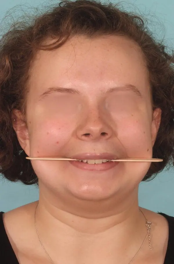 Figure 27 Transverse plane frontal view looking for any asymmetry with a - фото 6