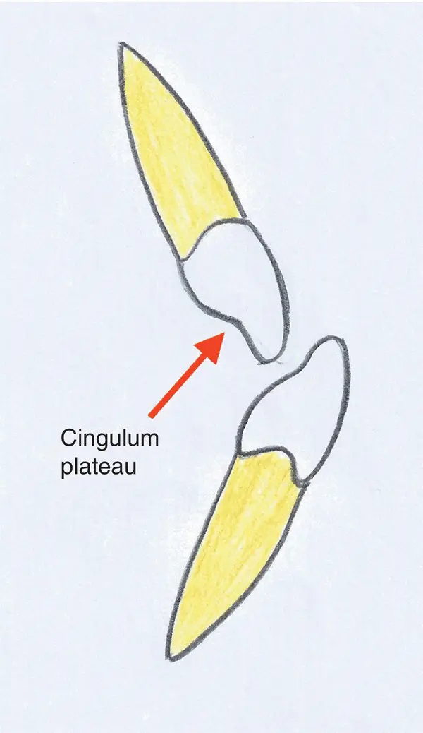 Figure 37 Incisor relationship class III Figure 38 Class I canine - фото 14