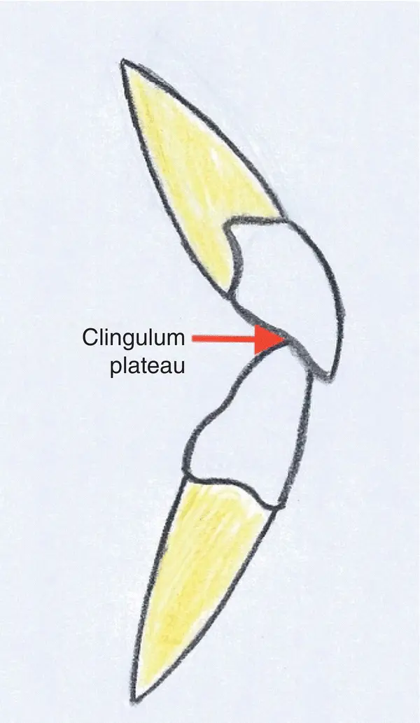 Figure 34 Incisor relationship class I 33 Canine Relationship This - фото 11