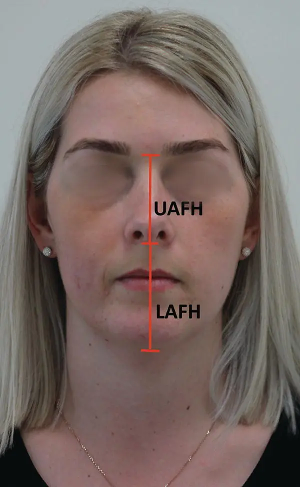 Figure 24 Vertical plane measurements frontal view 223 Transverse Plane - фото 5