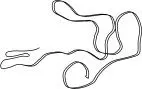 Taenia saginata Generally asymptomatic but can cause mild intestinal - фото 14